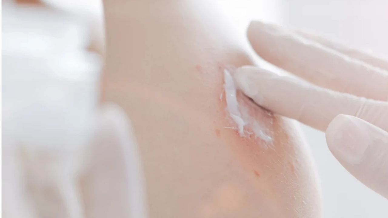 Dermatologie thumbnail