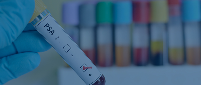 Man sieht eine PSA Blutprobe.