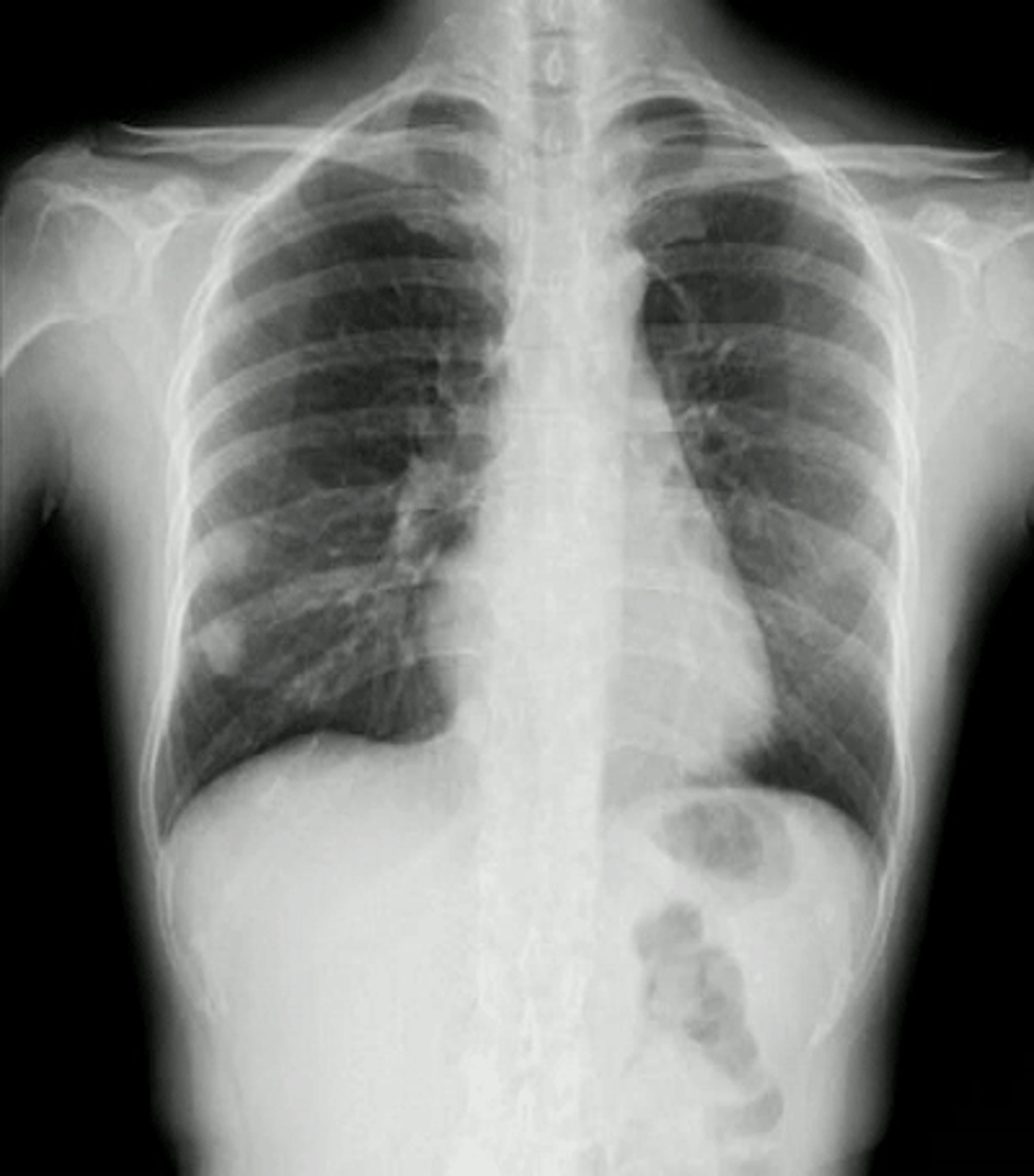 generic-media-pages-at-18544-dynamische-digitale-radiographie-11-1.webp