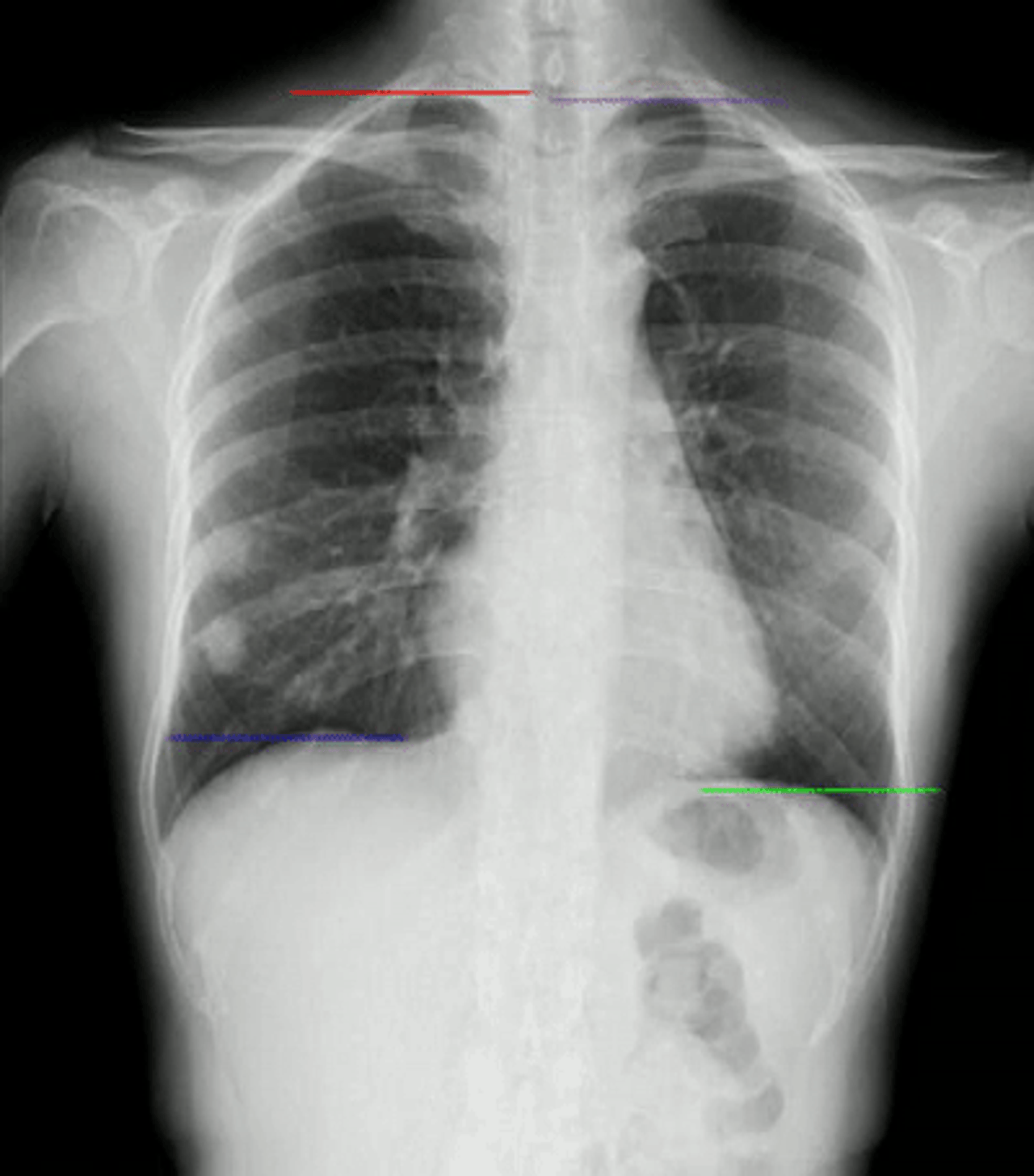 generic-media-pages-at-18544-dynamische-digitale-radiographie-8-0.webp
