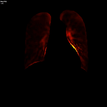 Video DDR - Lungs