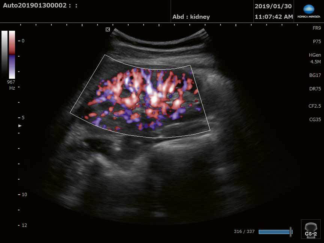 generic-media-pages-at-18774-sonimage-mx1-platinum-ultraschall-der-nchsten-generation-4-0.webp
