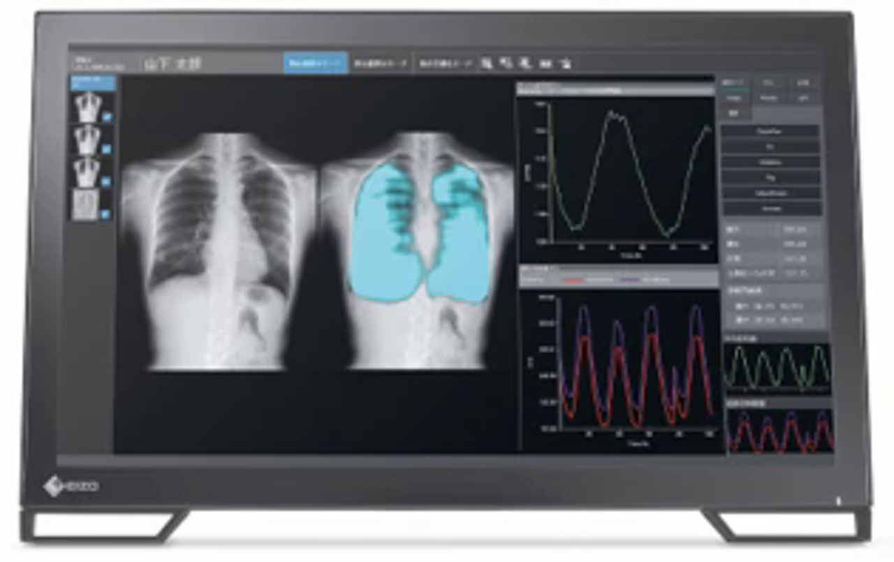 generic-media-pages-at-18544-dynamische-digitale-radiographie-3-0.webp