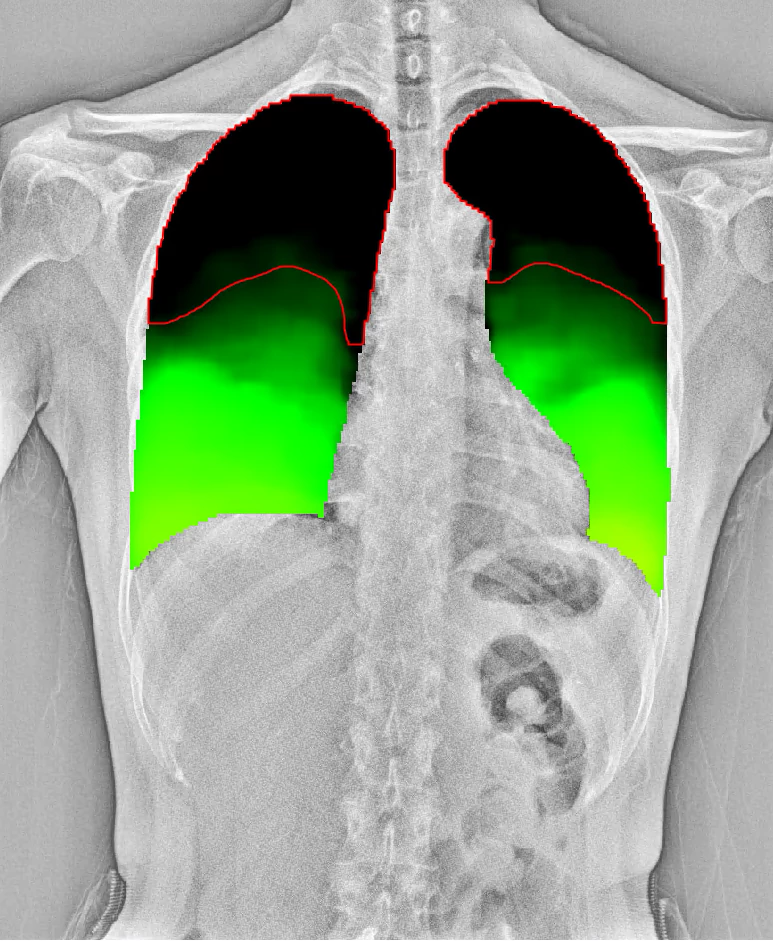 generic-media-pages-de-23530-dynamische-digitale-radiographie-5-2.webp