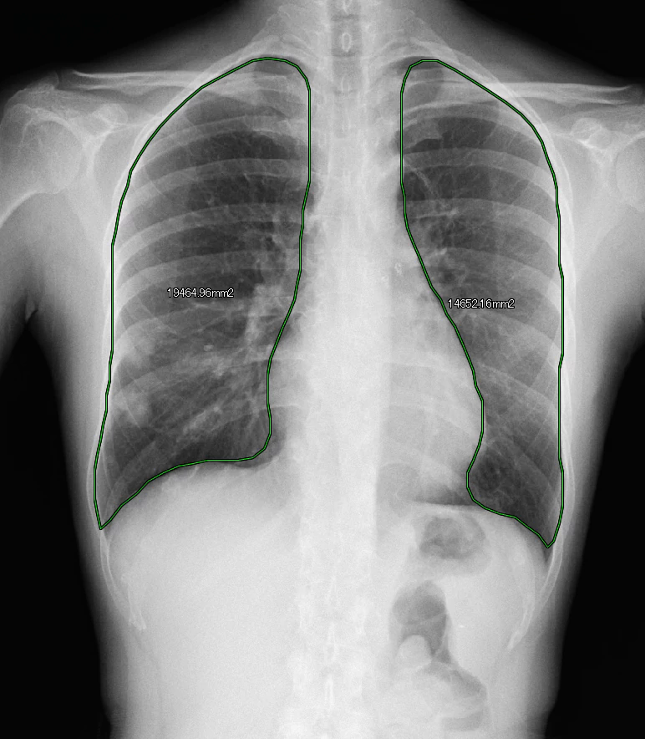 generic-media-pages-at-18544-dynamische-digitale-radiographie-8-2.webp