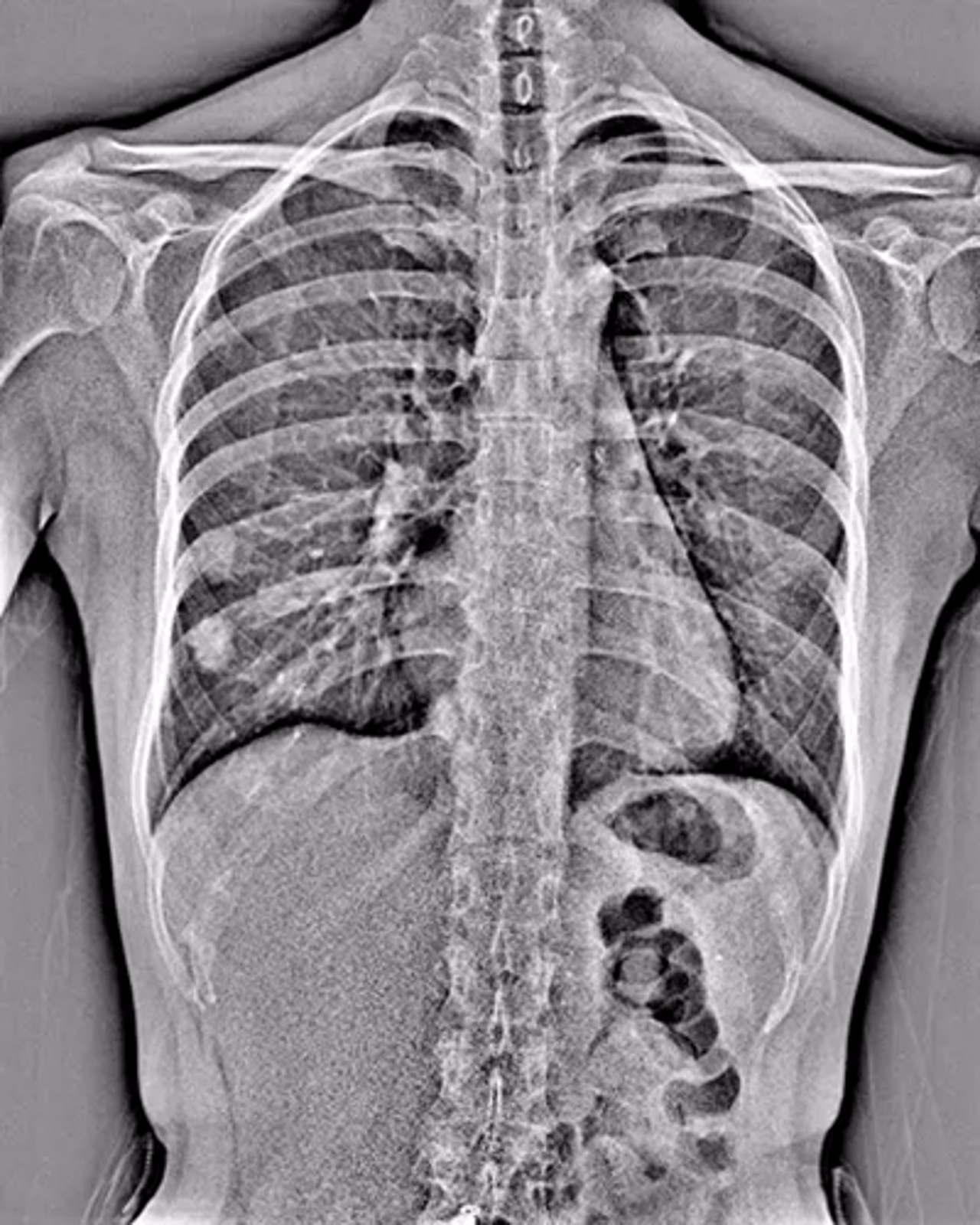 generic-media-pages-at-18544-dynamische-digitale-radiographie-5-1.webp