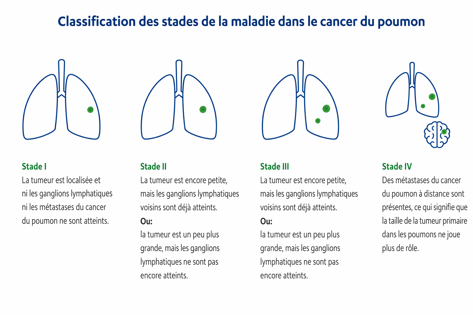CH-FR-cancer-du-poumon-classification-des-stades-de-la-maladie-dans-le-cancer-du-poumon