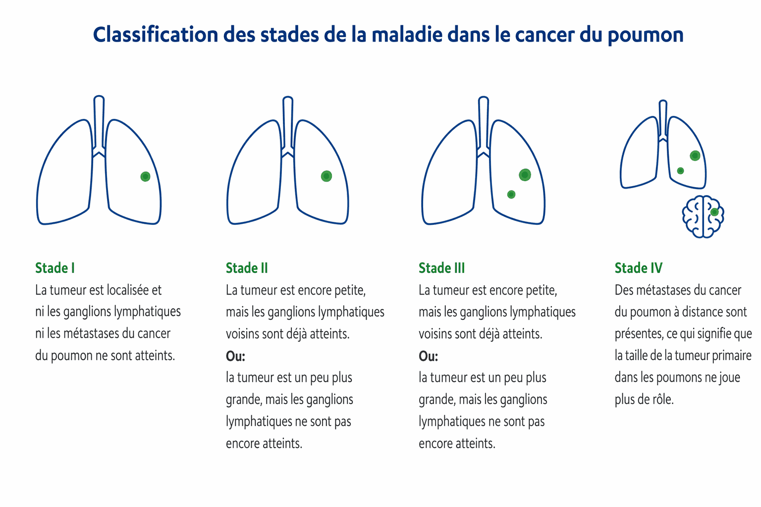 Vue d'ensemble des stades du cancer du poumon CH-FR-cancer-du-poumon-classification-des-stades-de-la-maladie-dans-le-cancer-du-poumon