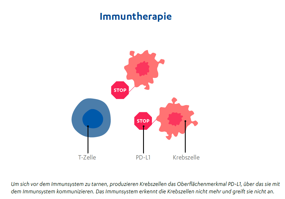 Immuntherapie | Janssen With Me