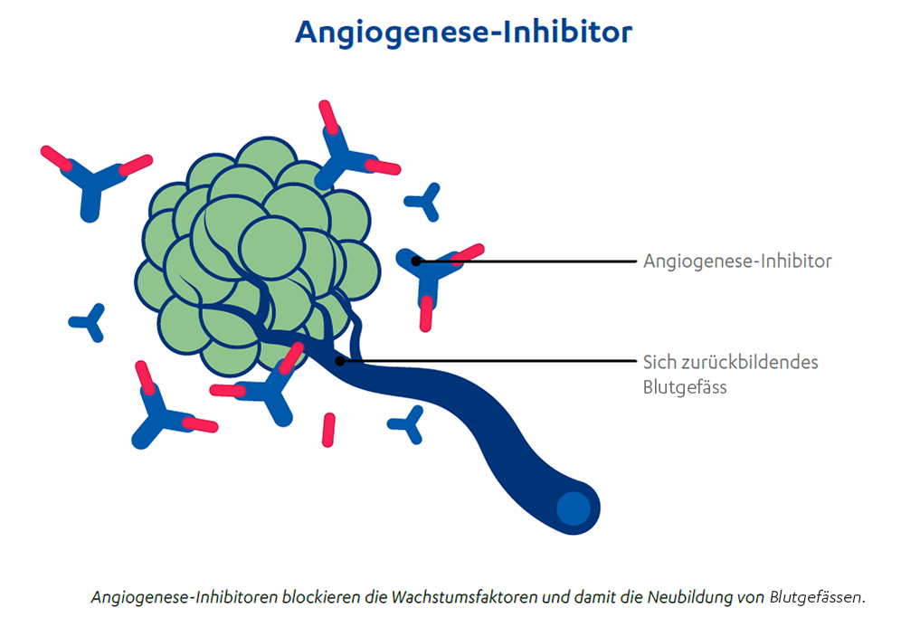 CH-DE-lungenkrebs-angiogenese-inhibitor