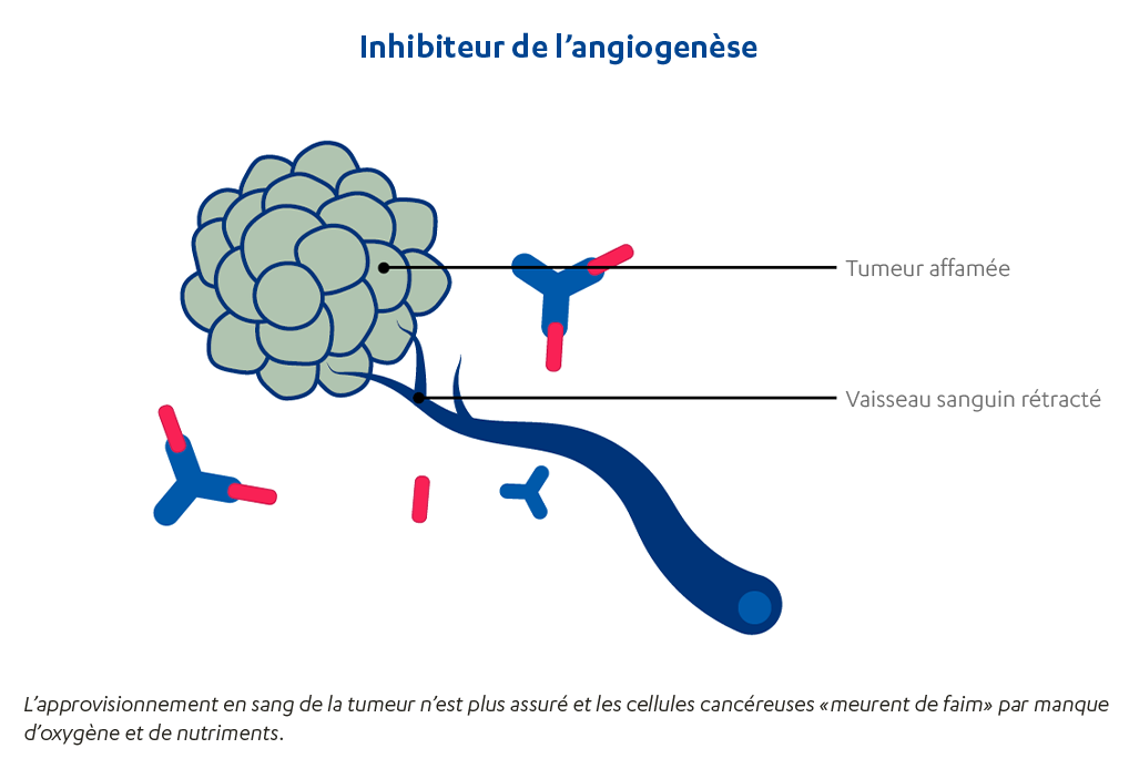 CH-FR-cancer-du-poumon-inhibiteur-de-l-angiogenese3