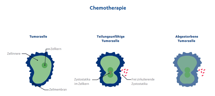 Chemotherapie chemotherapie