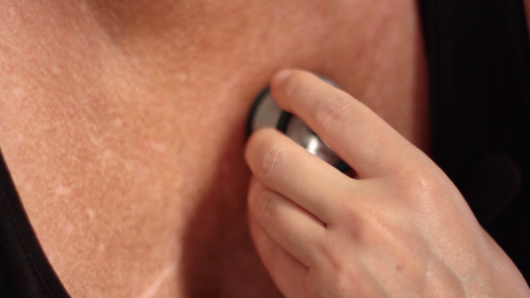 De klachten en symptomen van PAH zijn a-specifiek en lastig te herkennen