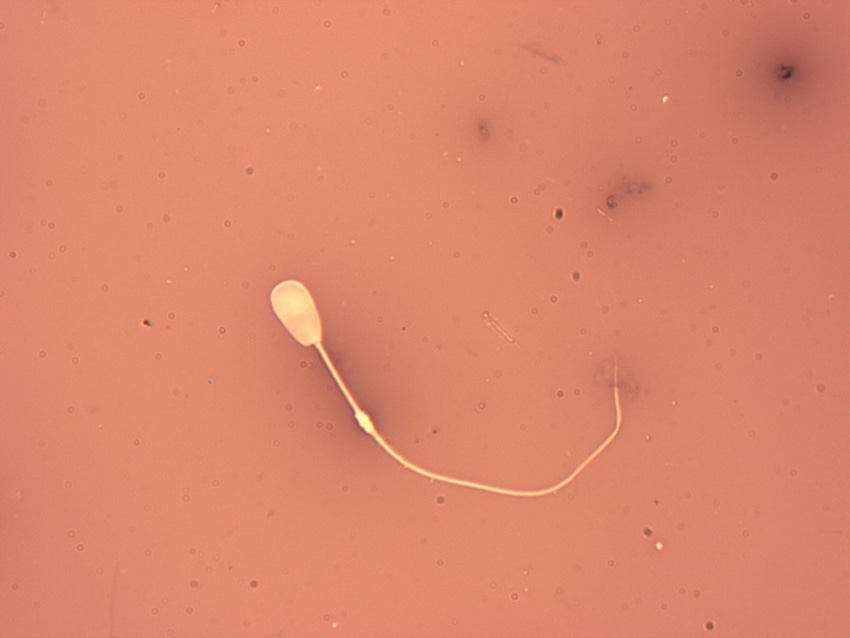 Sperm cell with abaxial tail and distal droplet