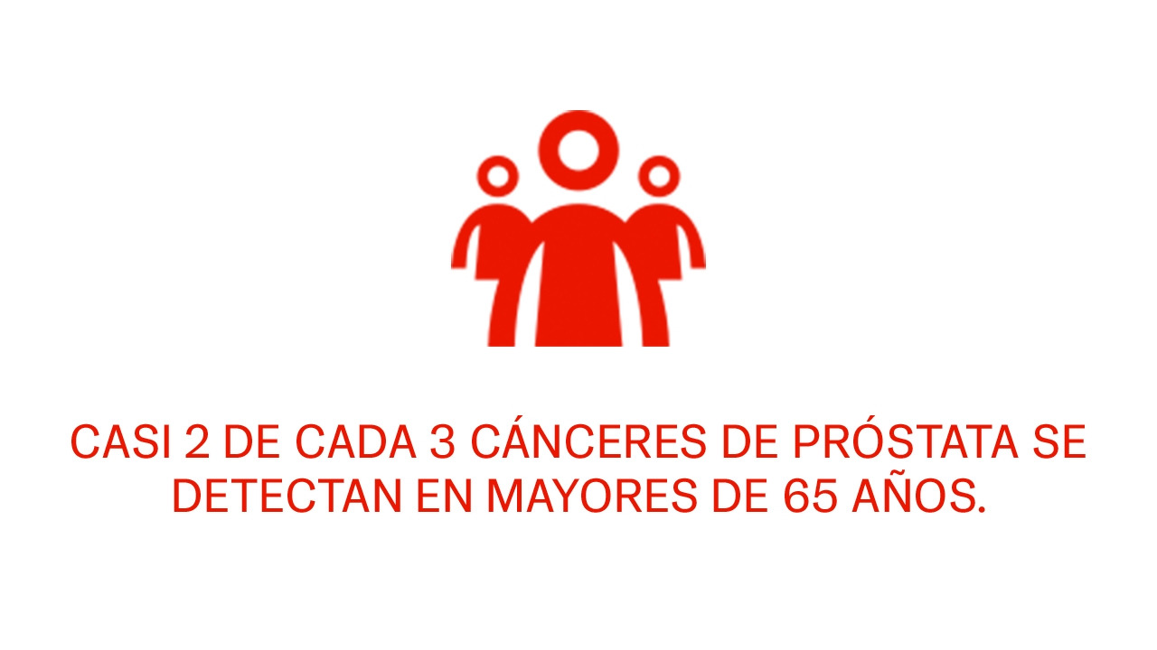 cáncer de vejiga urinaria, segundo tumor en hombres