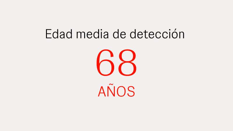 LCM edad media de detección LCM edad media de detección