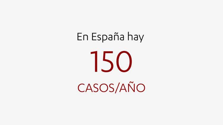 En España hay 150 casos/año