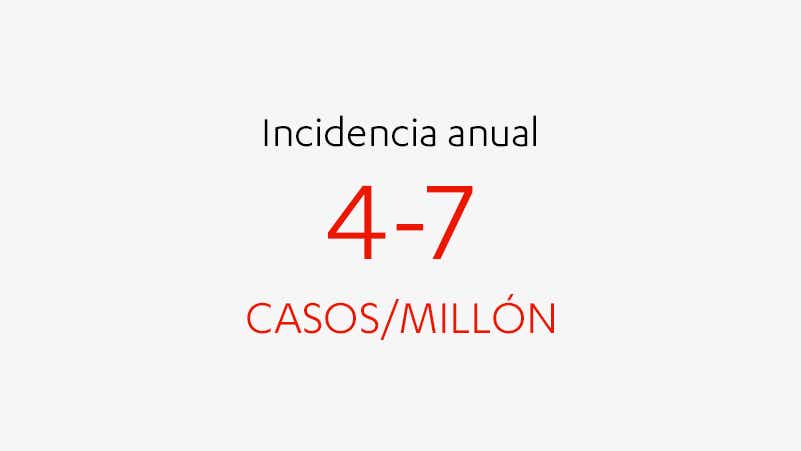 Incidencia anual Incidencia anual de la macroglobulinemia de Waldenström