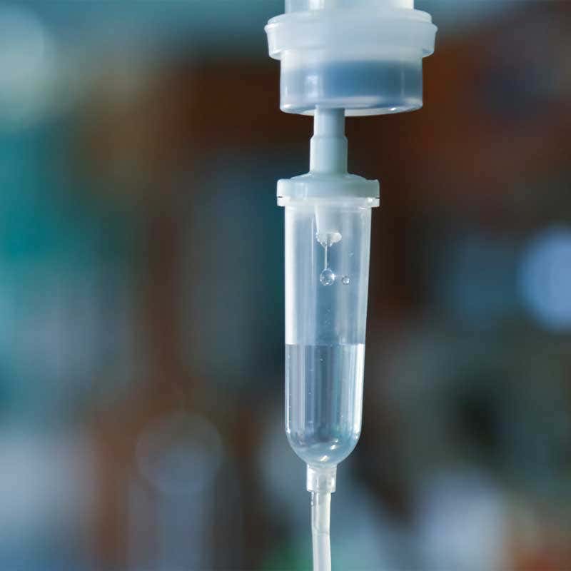 Tratamiento del cáncer de pulmón con quimioterapia.