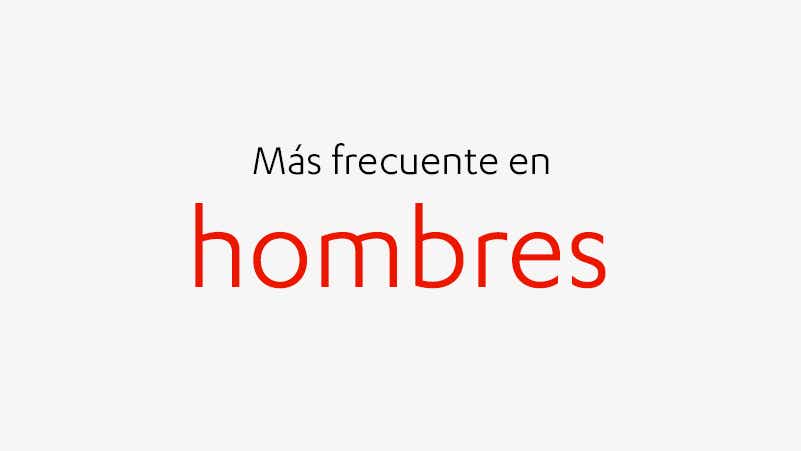 Más frecuente en hombres Más frecuente en hombres