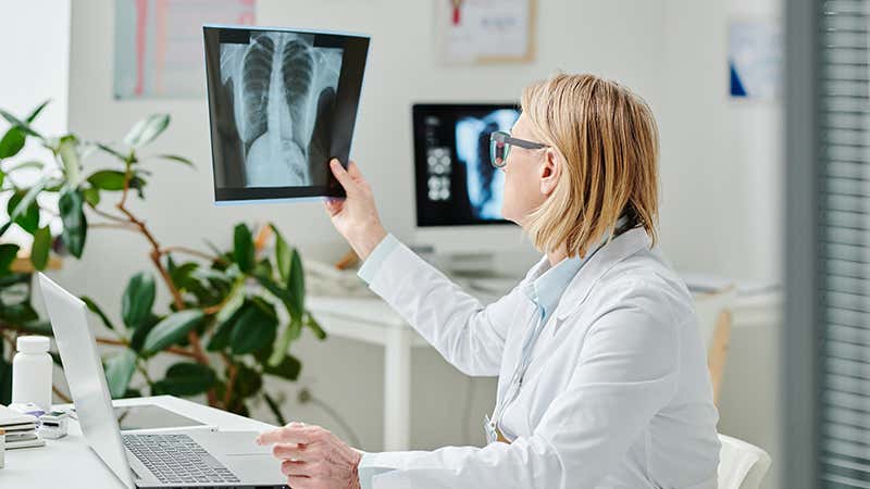Cáncer de pulmón hoy. Doctora revisando una radiografía de pulmón.