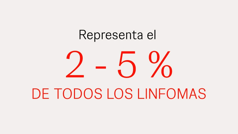 El LCM representa entre el  2 - 5% de los linfomas