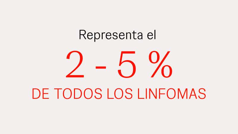 Porcentaje del LCM entre totalidad de linfomas El LCM representa entre el 2 - 5% de los linfomas
