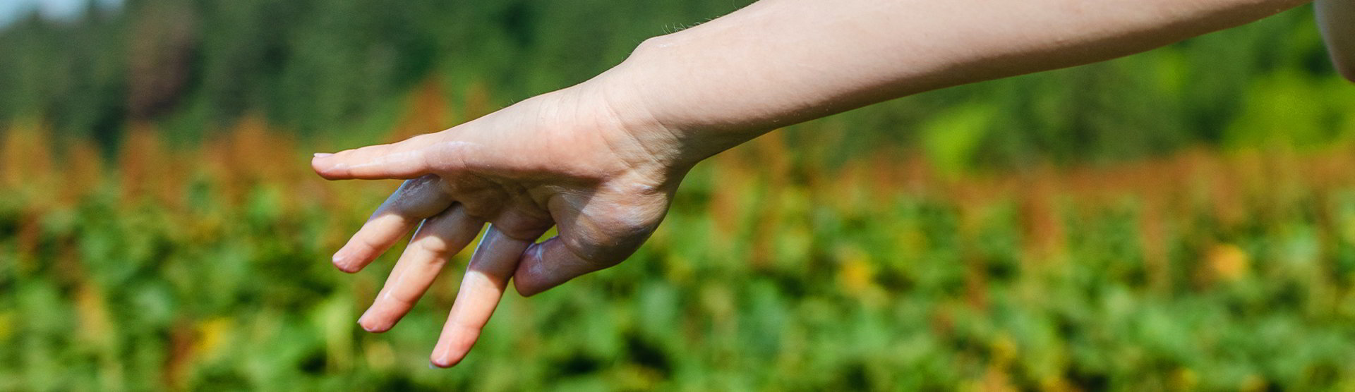 Información acerca de las afectaciones de la piel que pueden manifestarse por la colitis ulcerosa