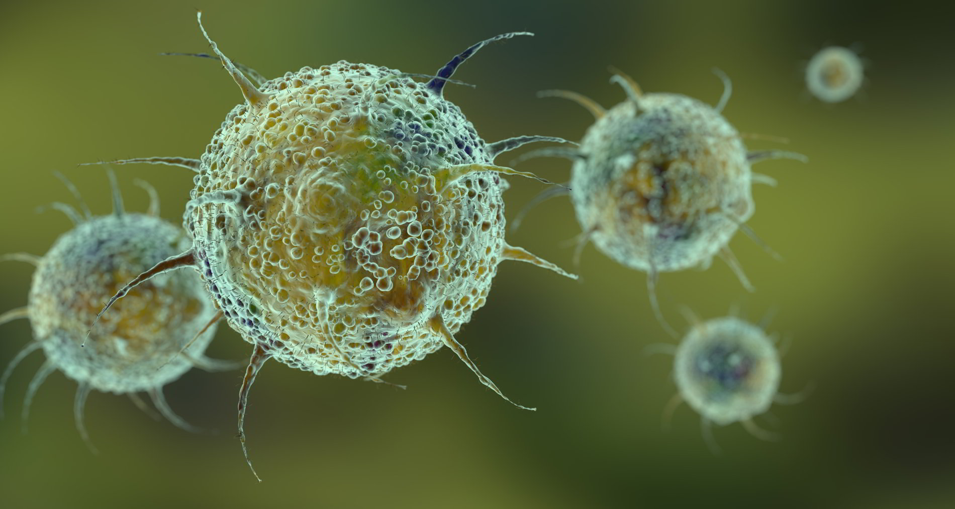 Algunos virus y bacterias suponen factores de riesgo para el desarrollo del linfoma de células del manto