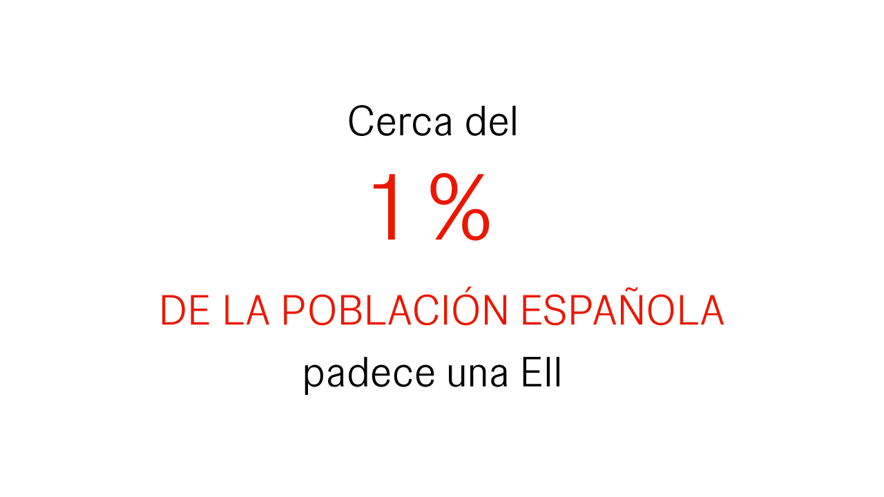 Como afecta la enfermedad de crohn a la población española
