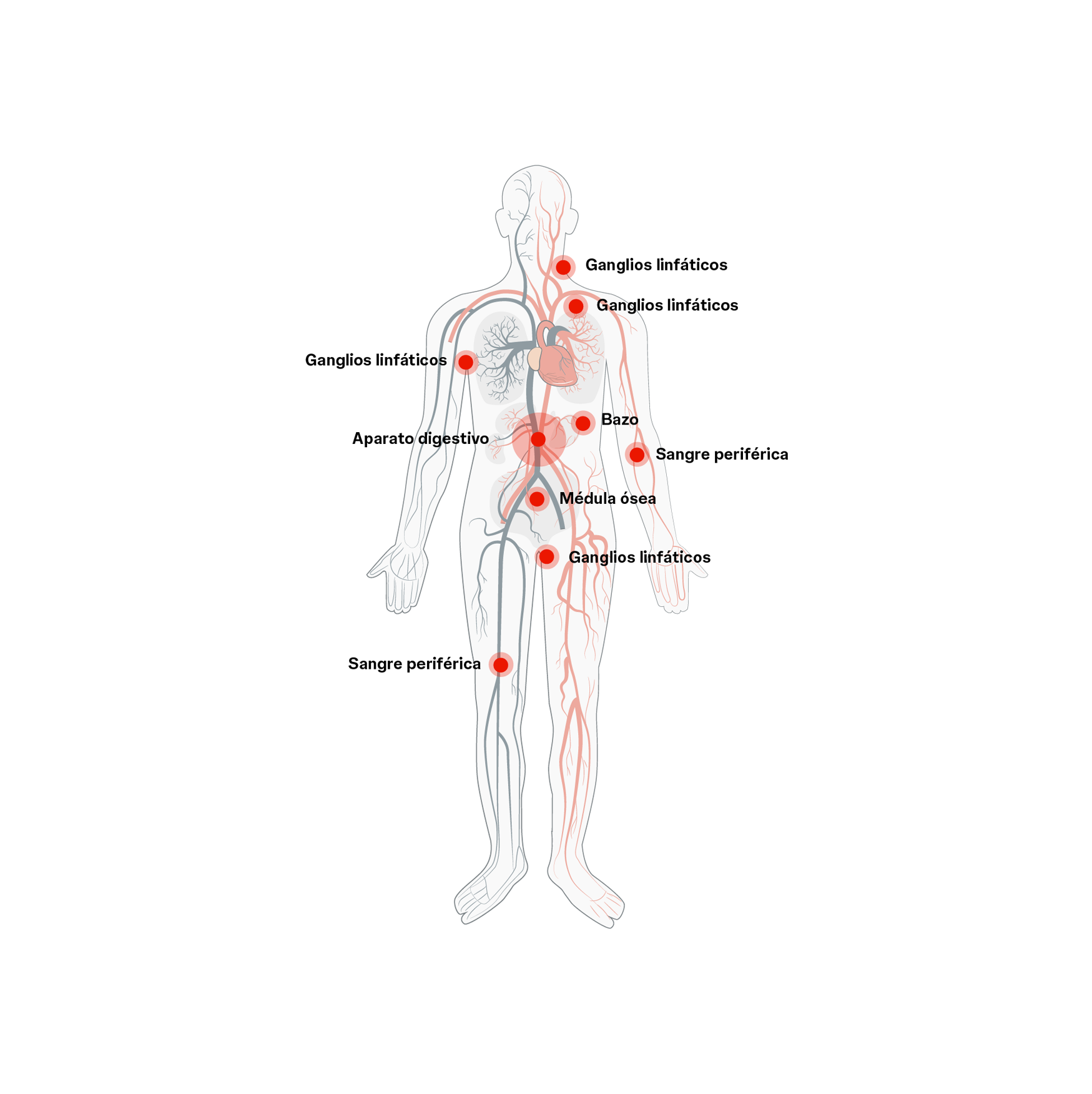 Diversas zonas del cuerpo pueden verse afectadas por el linfoma de células del manto