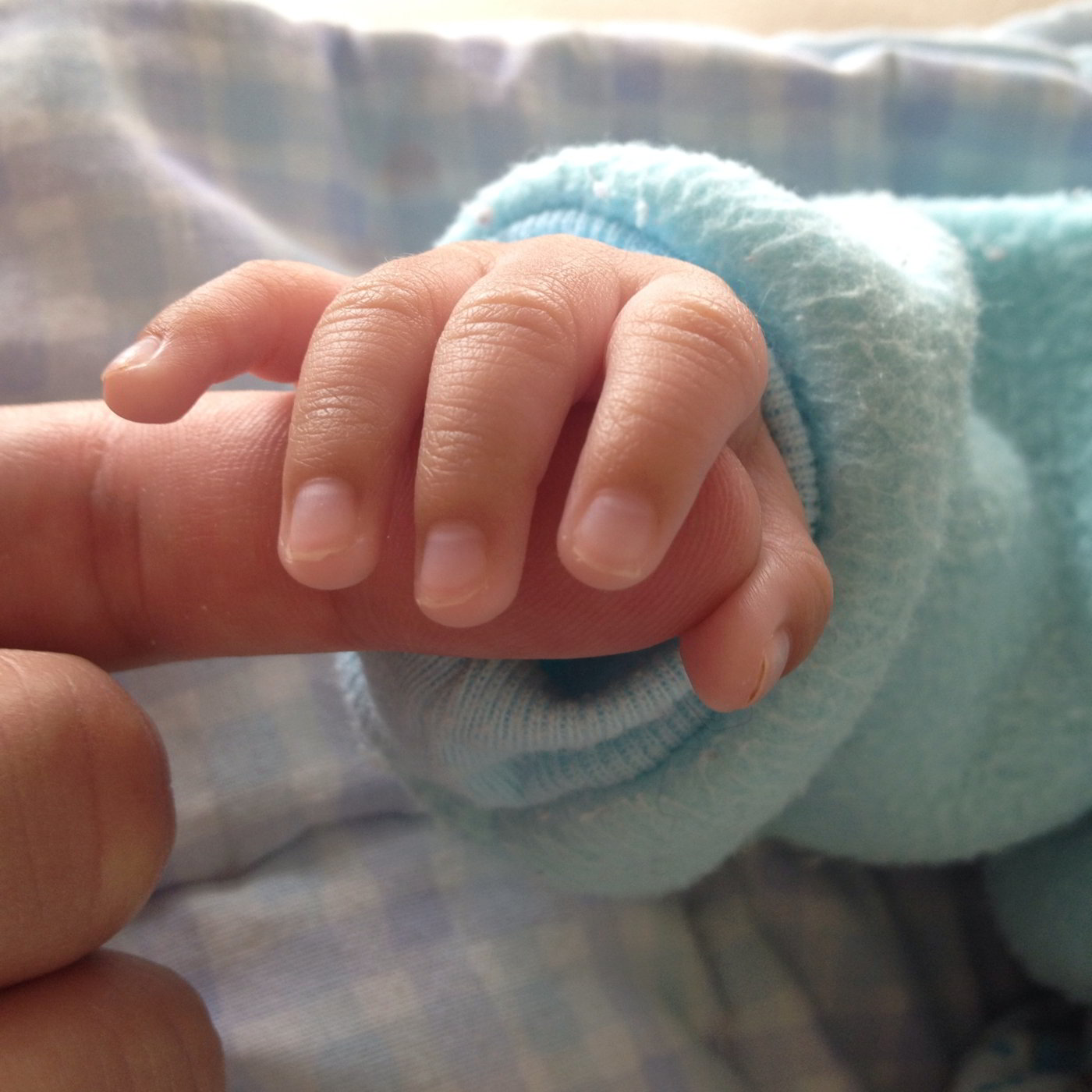 La predisposición genética puede tener que ver con el desarrollo de la colitis ulcerosa