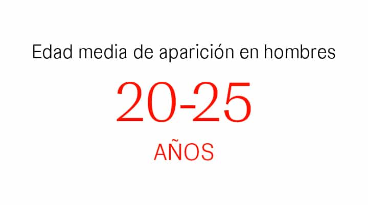 Hombres: más frecuente entre 18 - 25 años Hombres: más frecuente entre 18 - 25 años