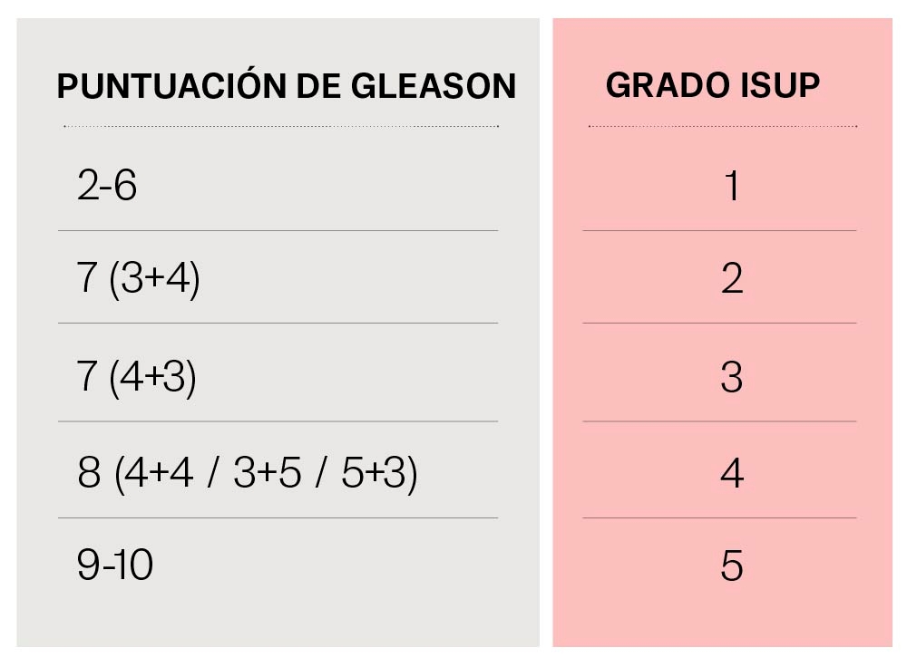 Cáncer de próstata tabla estadios