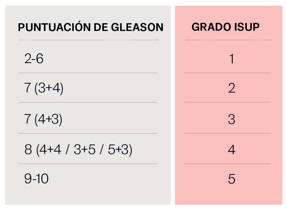 Cáncer de próstata tabla estadios Cáncer de próstata tabla estadios