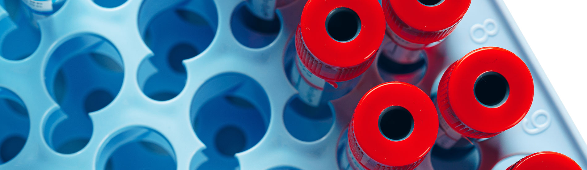 La enfermedad mínima residual (EMR) en el mieloma múltiple