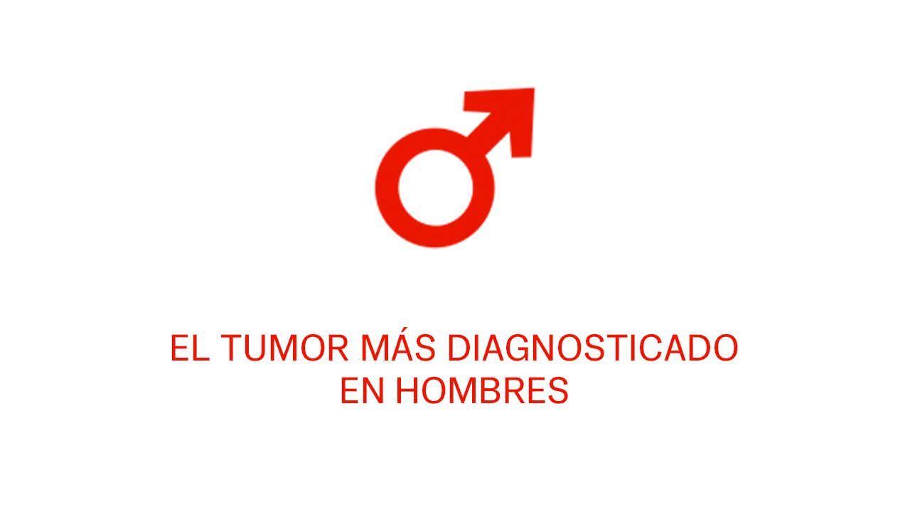 tumor mas frecente en hombre tumor mas frecente en hombre
