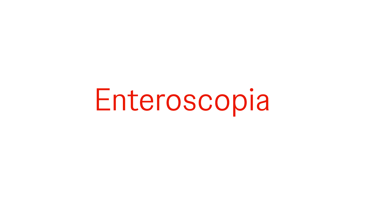 La enteroscopia es un procedimiento que se realiza cuando el diagnóstico de la enfermedad de Crohn es difícil