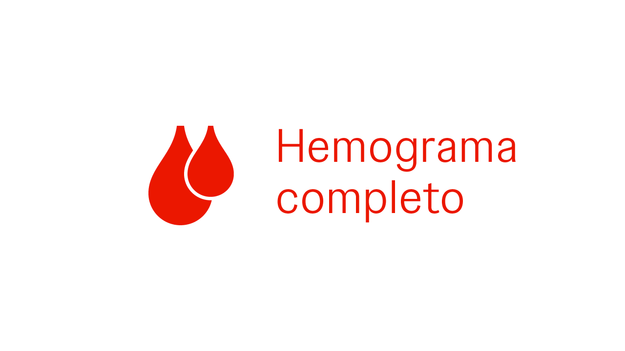 Análisis de sangre completo para diagnosticar macroglobulinemia de Waldenström