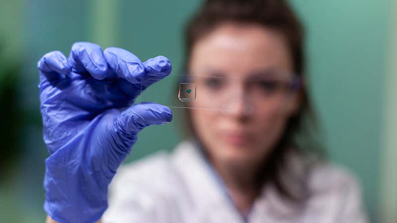 Biomarcadores para diagnosticar un cáncer de pulmón