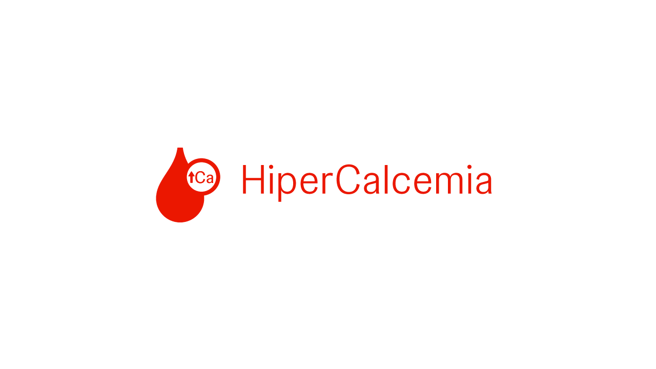La hipercalcemia, nivel de calcio en sangre superior al normal, es uno de los síntomas del mieloma múltiple