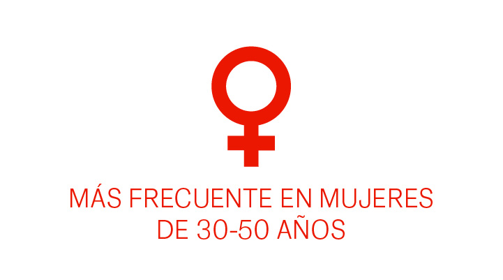 Edades de frecuencia en mujeres