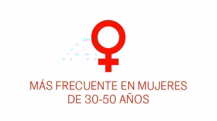 Edades de frecuencia en mujeres Edades de frecuencia en mujeres