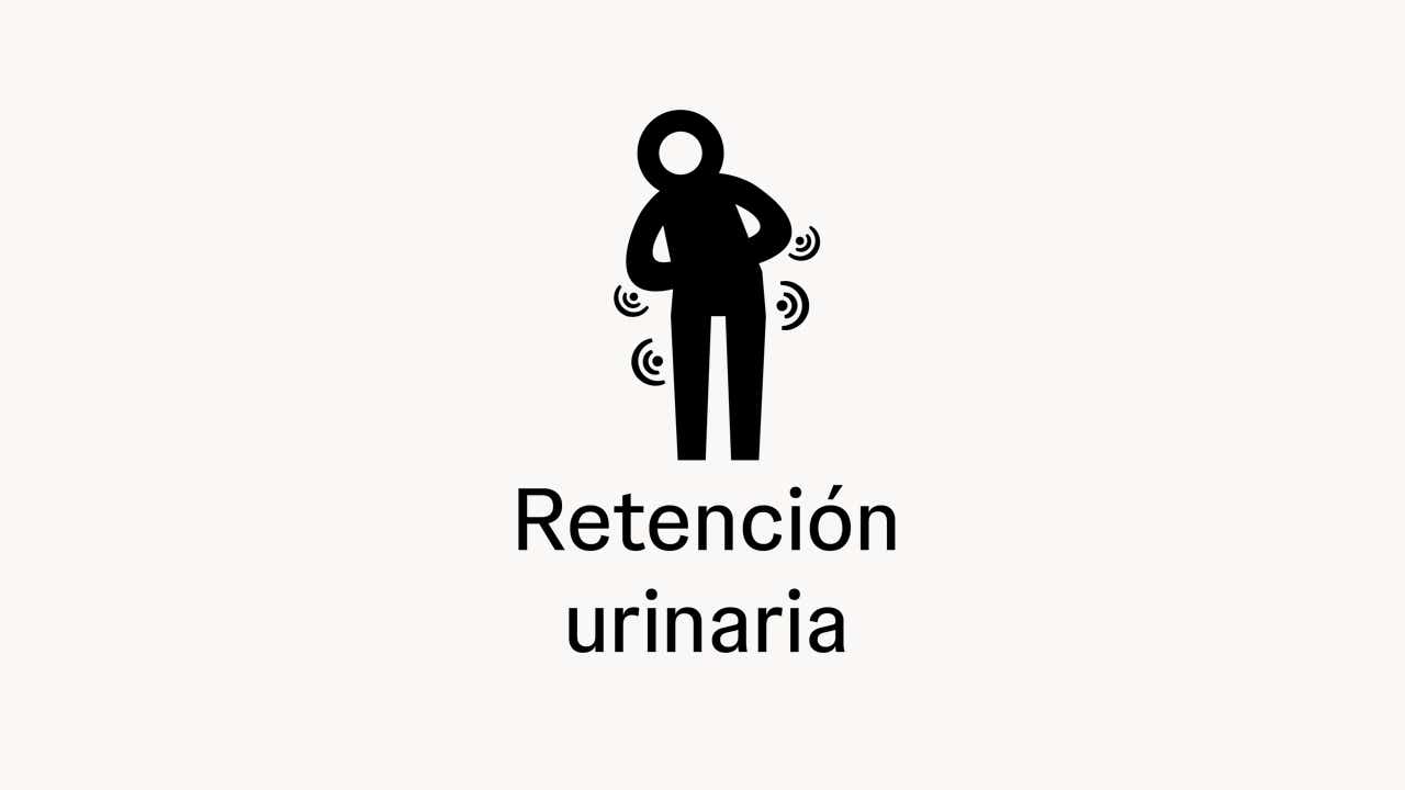 Retención urinaria Retención urinaria