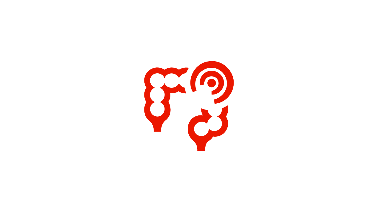 En la colitis ulcerosa la inflamación es continuada, mientras que en la enfermedad de Crohn es parcheada