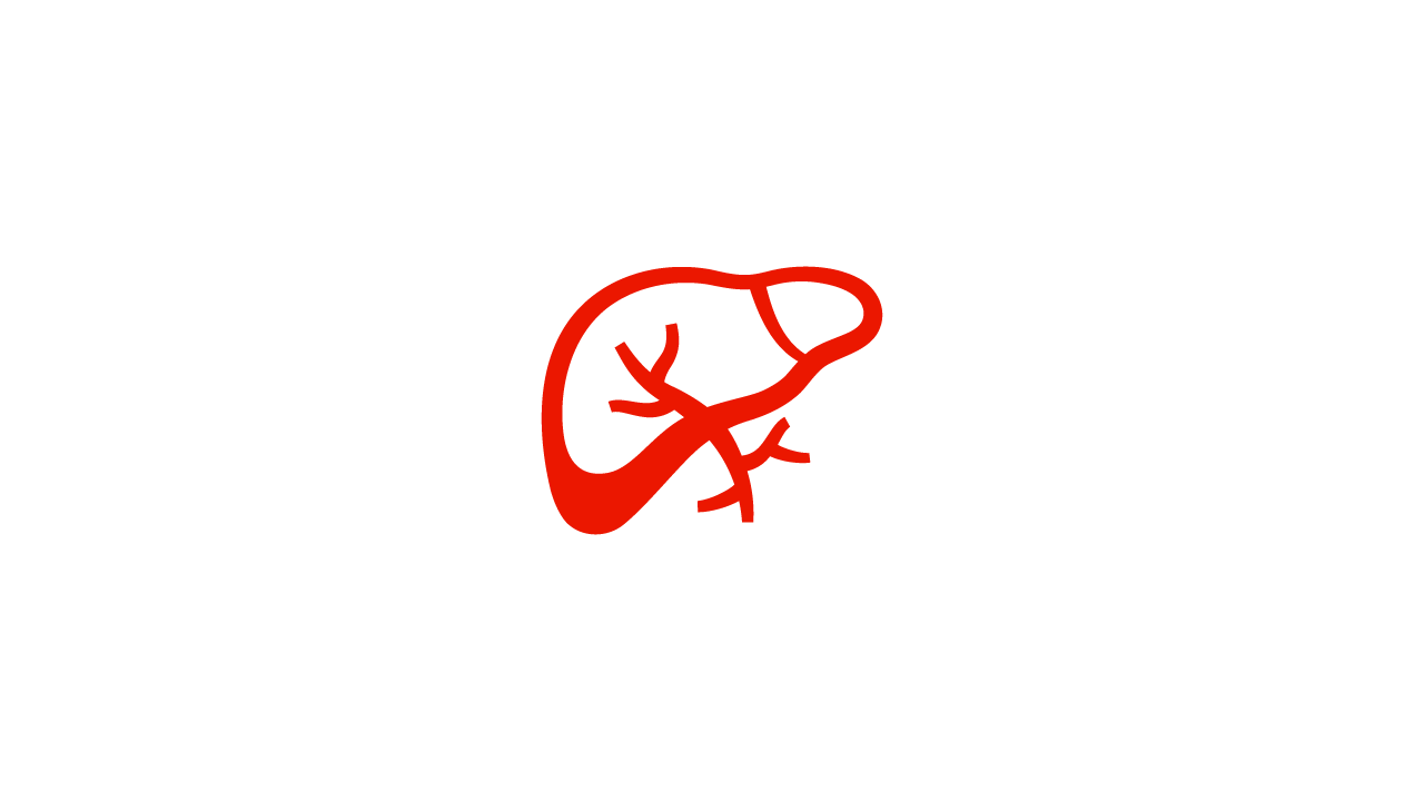 El hígado puede agrandarse como síntoma de la macroglobulinemia de Waldenström