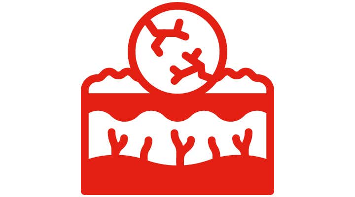 Psoriasis, limitaciones de los índices tradicionales