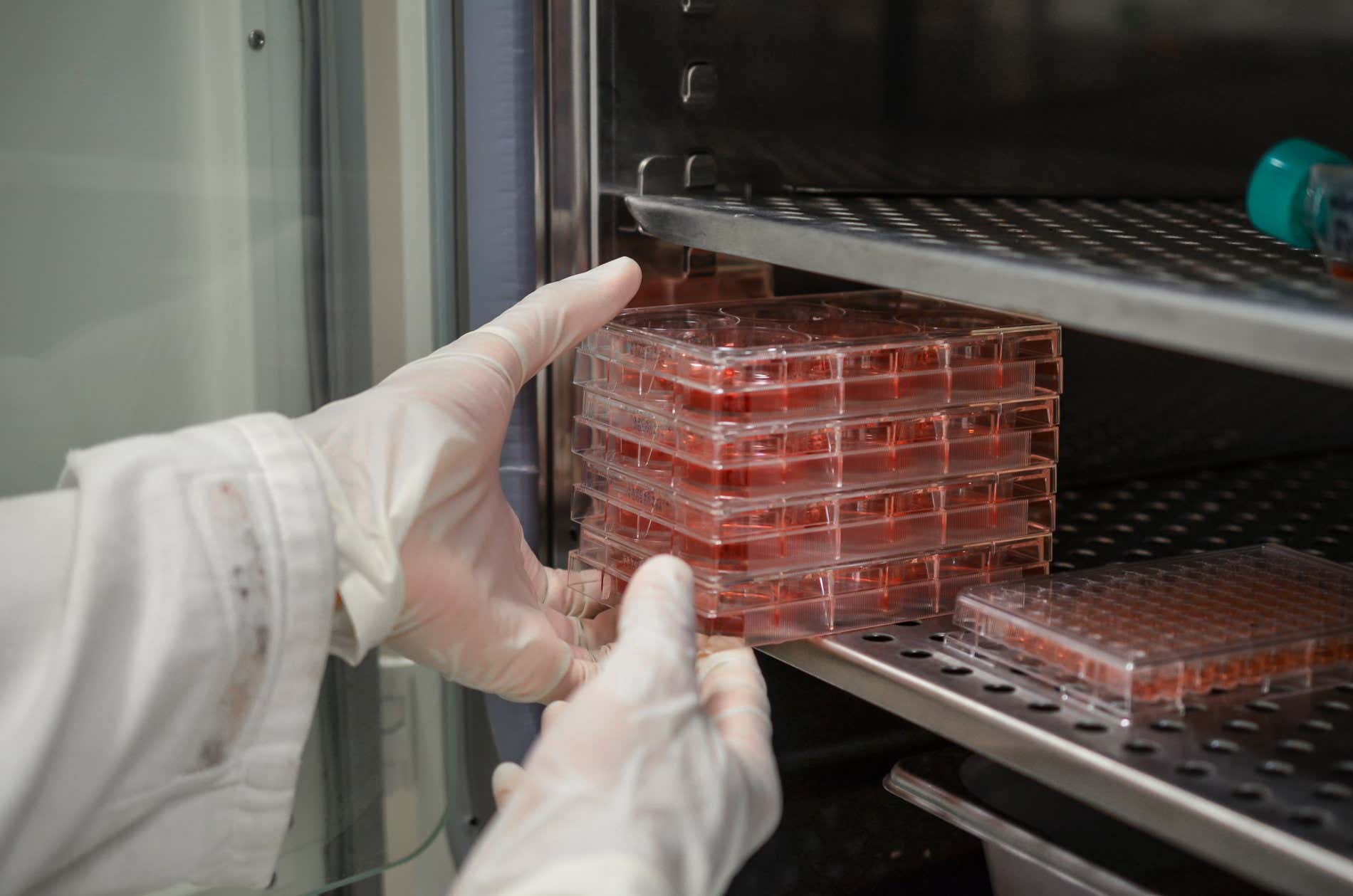 Otras pruebas se pueden emplear para diagnosticar macroglobulinemia de Waldenström