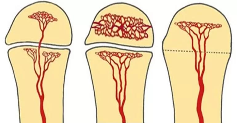 Painful hip figure 1.jpg Painful hip figure 1.jpg