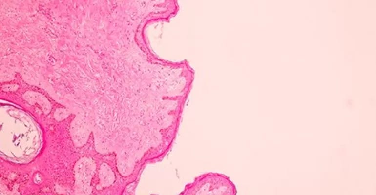 Mammography images Mammography images